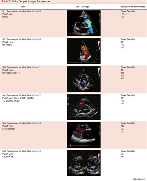 normal 2d echo|Guidelines for Performing a Comprehensive Transthoracic .